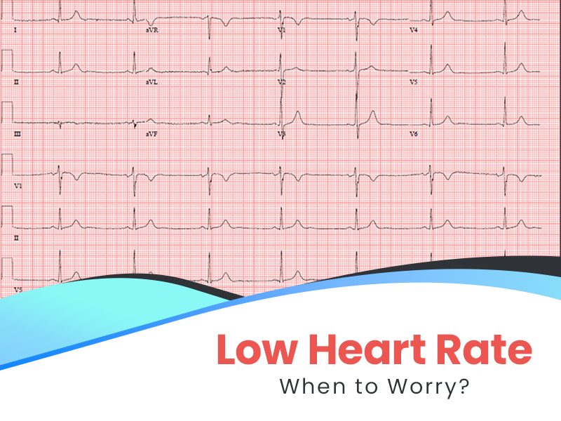 Dont Ignore the Signs Of Bradycardia